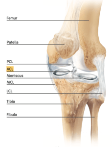 ACL Ligament